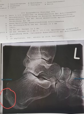 Ist an beiden Füßen