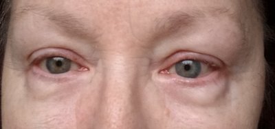 Augen 27.01.20-3.jpg