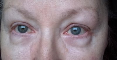 Augen 27.01.20--5.jpg